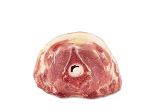 Neck